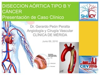 DISECCION AÓRTICA TIPO B Y
CÁNCER
Presentación de Caso Clínico
Dr. Gerardo Peón Peralta
Angiología y Cirugía Vascular
CLÍNICA DE MÉRIDA
Junio 09, 2016
 