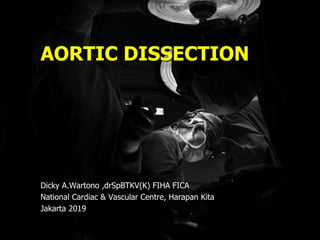 AORTIC DISSECTION
Dicky A.Wartono ,drSpBTKV(K) FIHA FICA
National Cardiac & Vascular Centre, Harapan Kita
Jakarta 2019
 