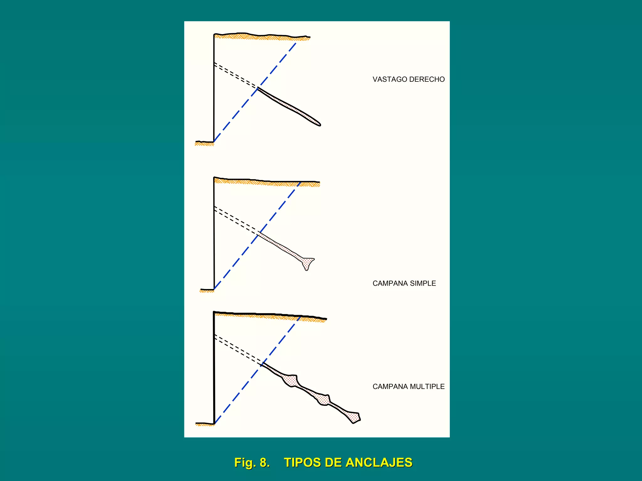 VASTAGO DERECHO
CAMPANA SIMPLE
CAMPANA MULTIPLE
Fig. 8. TIPOS DE ANCLAJESFig. 8. TIPOS DE ANCLAJES
 