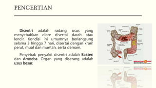 PENGERTIAN
Disentri adalah radang usus yang
menyebabkan diare disertai darah atau
lendir. Kondisi ini umumnya berlangsung
selama 3 hingga 7 hari, disertai dengan kram
perut, mual dan muntah, serta demam.
Penyebab penyakit disentri adalah Bakteri
dan Amoeba. Organ yang diserang adalah
usus besar.
 
