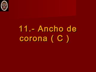 11.- Ancho de11.- Ancho de
corona ( C )corona ( C )
 