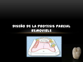 DISEÑO DE LA PROTESIS PARCIAL
REMOVIBLE

 