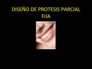 DISEÑO DE PROTESIS PARCIAL FIJA 