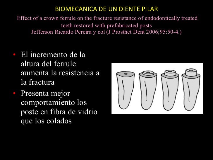 Diseño de protesis parcial fija 2
