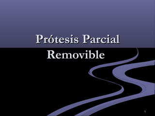 1
Prótesis ParcialPrótesis Parcial
RemovibleRemovible
 