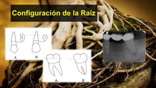 Configuración de la Raíz
 