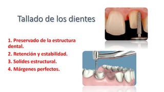 1. Preservado de la estructura
dental.
2. Retención y estabilidad.
3. Solides estructural.
4. Márgenes perfectos.
 