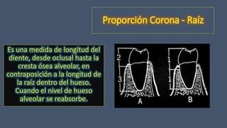 Proporción Corona - Raíz
Es una medida de longitud del
diente, desde oclusal hasta la
cresta ósea alveolar, en
contraposición a la longitud de
la raíz dentro del hueso.
Cuando el nivel de hueso
alveolar se reabsorbe.
 