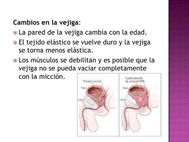 Si si la osteocondrosis es posible subirse sobre la barra fija