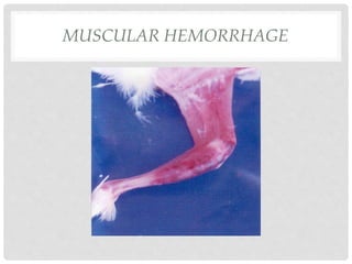 MUSCULAR HEMORRHAGE
 