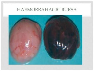 HAEMORRAHAGIC BURSA
 