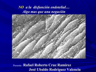 NO a la disfunción endotelial…
Algo mas que una negación
Presenta : Rafael Roberto Cruz Ramírez
José Ubaldo Rodríguez Valencia
 