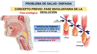 PROBLEMA DE SALUD: DISFAGIA
CONCEPTO PREVIO: FASE INVOLUNTARIA DE LA
DEGLUCIÓN
PERISTALSIS PRIMARIA
disparada por el reflejo de la
deglución en la faringe
PERISTALSIS SECUNDARIA
mediada por el SNE.
Fase esofágica:
RICARDO CARRILLO - MEDICINA HUMANA
 