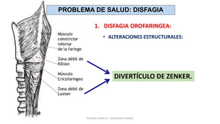 DIVERTÍCULO DE ZENKER.
PROBLEMA DE SALUD: DISFAGIA
1. DISFAGIA OROFARINGEA:
• ALTERACIONES ESTRUCTURALES:
RICARDO CARRILLO - MEDICINA HUMANA
 