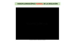 VIDEOFLUOROSCÓPICO NORMAL DE LA DEGLUCIÓN
RICARDO CARRILLO - MEDICINA HUMANA
 
