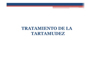 TRATAMIENTO DE LA
TARTAMUDEZ
 