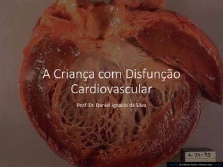 A Criança com Disfunção
Cardiovascular
Prof. Dr. Daniel Ignacio da Silva
This Photo by Unknown Author is licensed under CC BY-SA
 