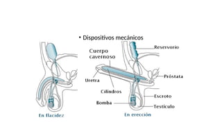 • Dispositivos mecánicos
 