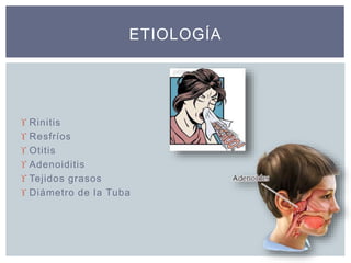  Rinitis
 Resfríos
 Otitis
 Adenoiditis
 Tejidos grasos
 Diámetro de la Tuba
ETIOLOGÍA
 