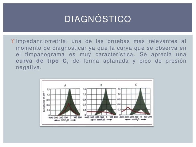 weber and rinne test