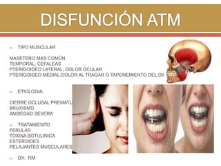 

TIPO MUSCULAR

MASETERO MAS COMÚN
TEMPORAL; CEFALEAS
PTERIGOIDEO LATERAL; DOLOR OCULAR
PTERIGOIDEO MEDIAL:DOLOR AL TRAGAR O TAPONEMIENTO DEL OIDO.



ETIOLOGIA:

CIERRE OCLUSAL PREMATURO
BRUXISMO
ANSIEDAD SEVERA
TRATAMIENTO
FERULAS
TOXINA BOTULINICA
ESTEROIDES
RELAJANTES MUSCULARES




DX: RM

 