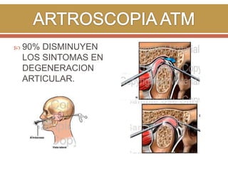  90%

DISMINUYEN
LOS SINTOMAS EN
DEGENERACION
ARTICULAR.

 