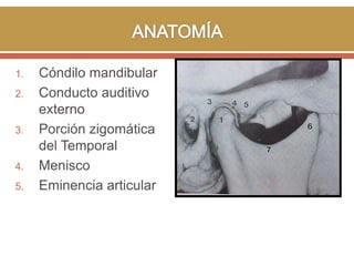 1.
2.

3.

4.
5.

Cóndilo mandibular
Conducto auditivo
externo
Porción zigomática
del Temporal
Menisco
Eminencia articular

 