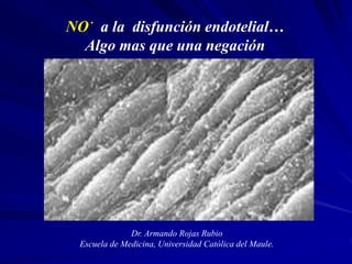 NO
.
a la disfunción endotelial…
Algo mas que una negación
Dr. Armando Rojas Rubio
Escuela de Medicina, Universidad Católica del Maule.
 