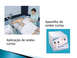 Aplicação de ondas
curtas
Aparelho de
ondas curtas
 