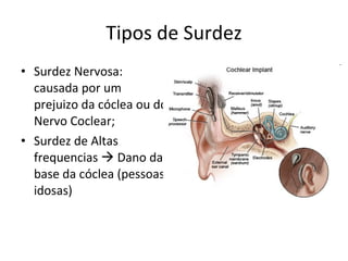 Tipos de Surdez Surdez Nervosa: causada por um prejuizo da cóclea ou do Nervo Coclear; Surdez de Altas frequencias    Dano da base da cóclea (pessoas idosas) 