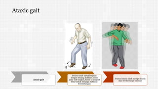 Ataxic gait
Ataxic gait
Pasien susah untuk berjalan
dengan tenang, fluktuasi tonus
pada otot tungkai, based of support
lebar untuk menjaga stabilitas
keseimbangan
Truncal ataxia tidak mampu duduk
atau berdiri tanpa bantuan
 