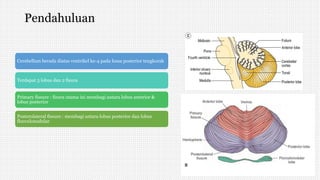 Pendahuluan
Cerebellum berada diatas ventrikel ke-4 pada fossa posterior tengkorak
Terdapat 3 lobus dan 2 fisura
Primary fissure : fisura utama ini membagi antara lobus anterior &
lobus posterior
Posterolateral fissure : membagi antara lobus posterior dan lobus
flocculonodular
 