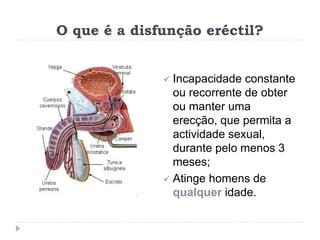 O que é a disfunção eréctil?
 Incapacidade constante
ou recorrente de obter
ou manter uma
erecção, que permita a
actividade sexual,
durante pelo menos 3
meses;
 Atinge homens de
qualquer idade.
 