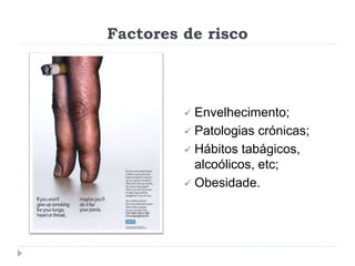 Factores de risco
 Envelhecimento;
 Patologias crónicas;
 Hábitos tabágicos,
alcoólicos, etc;
 Obesidade.
 