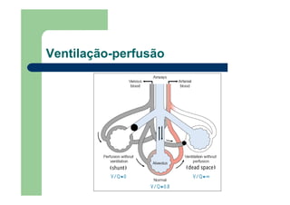Ventilação-perfusão
 