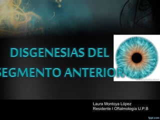 Laura Montoya López
Residente I Oftalmología U.P.B
 