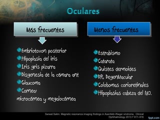 Disgenesias segmento anterior lml | PPT