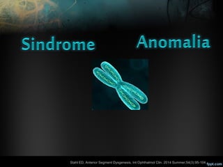 Disgenesias segmento anterior lml | PPT