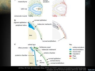 Disgenesias segmento anterior lml | PPT