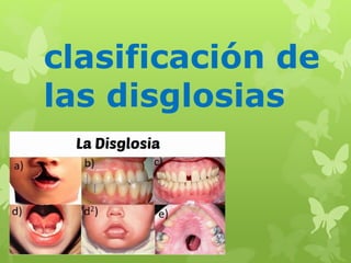 clasificación de 
las disglosias 
 