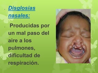  Disglosias 
nasales: 
 Producidas por 
un mal paso del 
aire a los 
pulmones, 
dificultad de 
respiración. 
 