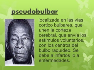 pseudobulbar 
localizada en las vías 
cortico bulbares, que 
unen la corteza 
cerebral, que envía los 
estímulos voluntarios, 
con los centros del 
bulbo raquídeo. Se 
debe a infartos o a 
enfermedades. 
 