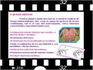 Trastornos del esquema corporal y de las funciones perceptivo-motrices. 