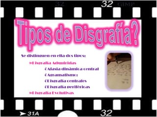 Trastornos de organización perceptiva. 