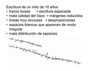 Escritura de un niño de 10 años.
• trazos torpes • escritura espaciada
• mala calidad del trazo • márgenes reducidos
• líneas muy sinuosas • desproporciones
• espacios blancos que aparecen de modo
irregular
• mala distribución de espacios
 