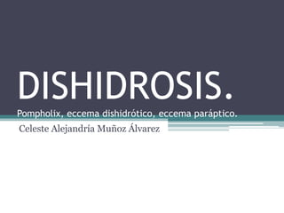 DISHIDROSIS. 
Pompholix, eccema dishidrótico, eccema paráptico. 
Celeste Alejandría Muñoz Álvarez 
 