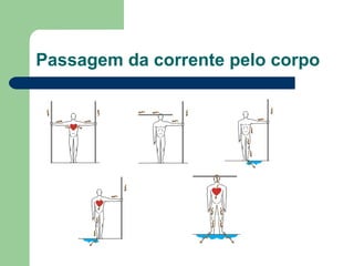 Passagem da corrente pelo corpo
 