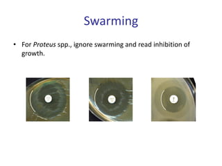 Swarming
• For Proteus spp., ignore swarming and read inhibition of
growth.
 