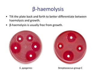 β-haemolysis
• Tilt the plate back and forth to better differentiate between
haemolysis and growth.
• β-haemolysis is usually free from growth.
S. pyogenes Streptococcus group C
 