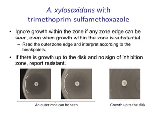 A. xylosoxidans with
trimethoprim-sulfamethoxazole
• Ignore growth within the zone if any zone edge can be
seen, even when growth within the zone is substantial.
– Read the outer zone edge and interpret according to the
breakpoints.
• If there is growth up to the disk and no sign of inhibition
zone, report resistant.
Growth up to the disk
An outer zone can be seen
 
